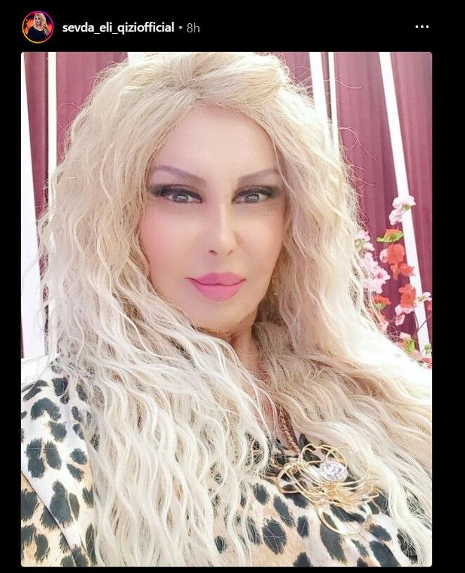 Sevda Əliqızı özünü tanınmaz hala saldı Sevda Əliqızı özünü tanınmaz hala saldı