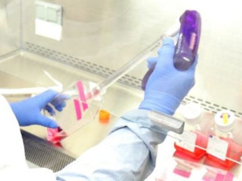 Rusiyada koronaya yoluxanların sayı artıb