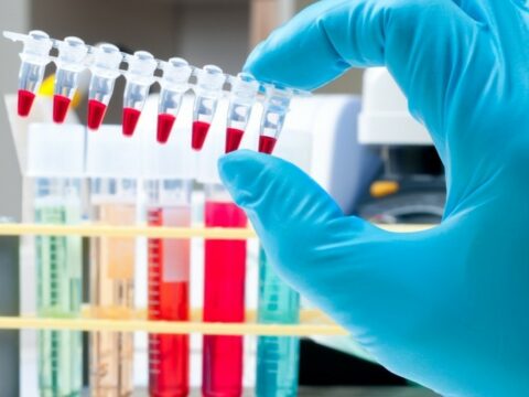 Azərbaycanın üç idmançısı antidopinq pozuntusuna görə cəzalandırılıb