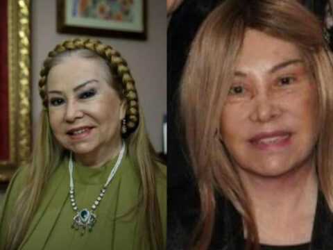 81 yaşlı türkiyəli sənətçi estetik əməliyyat etdirib tanınmaz oldu