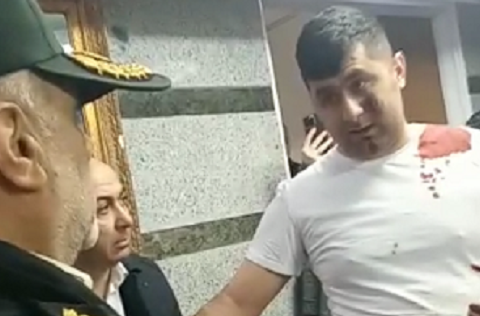 Terrorçunu zərərsizləşdirən qəhrəman əməliyyat olundu