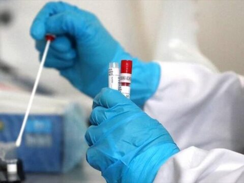 Azərbaycanda daha 33 nəfər COVID-19-a yoluxub, 1 nəfər vəfat edib