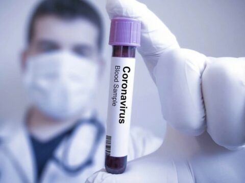 Azərbaycanda koronavirusa yoluxma 3 dəfə AZALIB