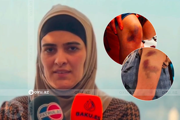 “Polkovnik ərim silahı başıma dirədi, dedi ki, ona xəyanət etdiyimi söyləyim” “Polkovnik ərim silahı başıma dirədi, dedi ki, ona xəyanət etdiyimi söyləyim”