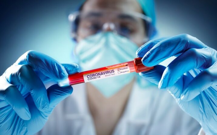 Yoluxma statistikası açıqlandı – 1 nəfər ÖLDÜ Yoluxma statistikası açıqlandı – 1 nəfər ÖLDÜ