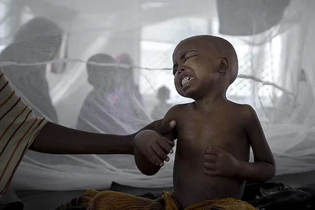 “Afrika ölkələrində vəba epidemiyası sürətlə yayılır” “Afrika ölkələrində vəba epidemiyası sürətlə yayılır”
