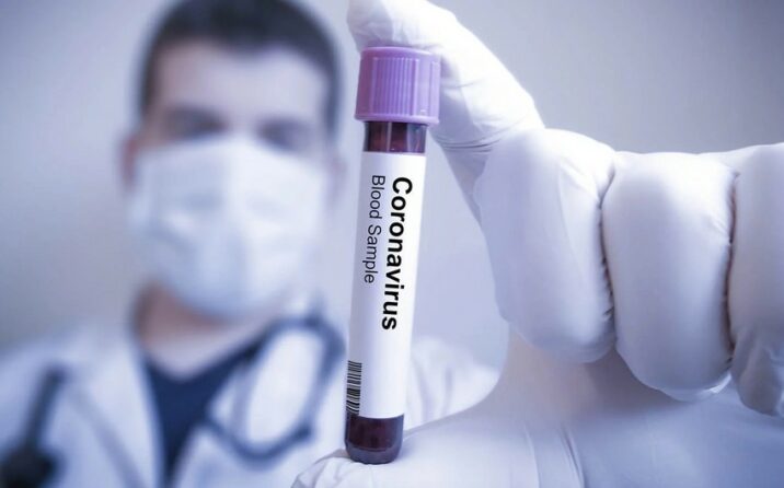 Azərbaycanda daha 53 nəfər koronavirusa yoluxub, 6 nəfər ölüb Azərbaycanda daha 53 nəfər koronavirusa yoluxub, 6 nəfər ölüb