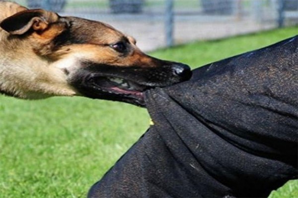 TƏBİB it dişləyən uşaqla bağlı məlumat YAYDI