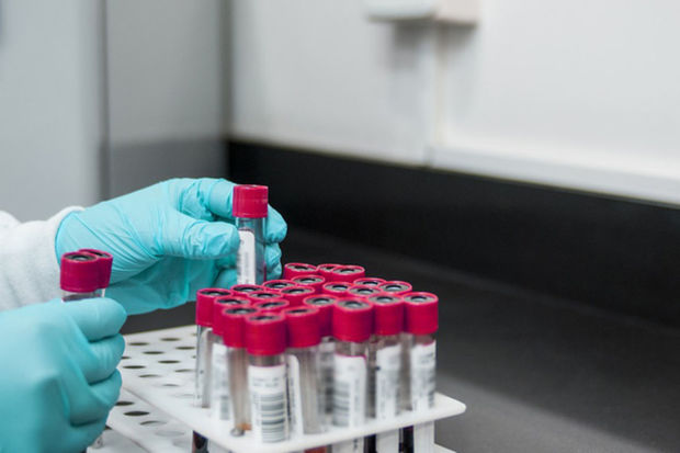 Dünyada altıncı xəstədə İİV infeksiyasının azalması qeydə alınıb