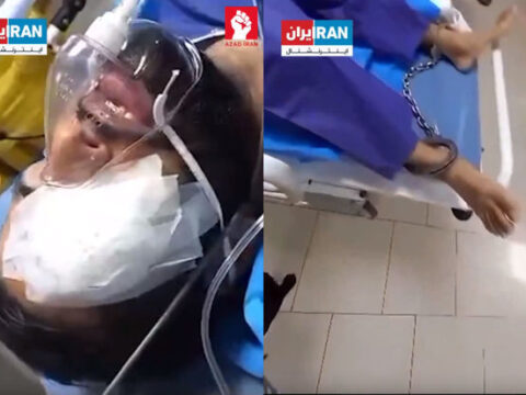 İran həbsxanasında vəziyyəti ağırlaşan etirazçı əlləri və ayaqları qandallı halda xəstəxanaya aparıldı