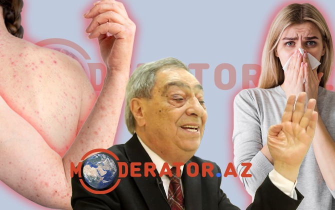 “Ölkədə qripin ağır növü yayılıb, mən özüm də ağır keçirdim”