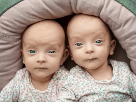 Siam əkizlərini 4 saatlıq riskli əməliyyatdan sonra ayırıblar