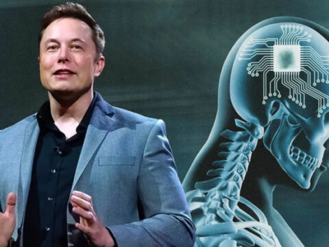 Dünyada bir ilk: İnsan beyninə çip yerləşdirildi