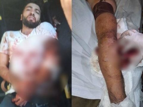 Ermənilər “Bakselin” əməkdaşını atəşə tutdu