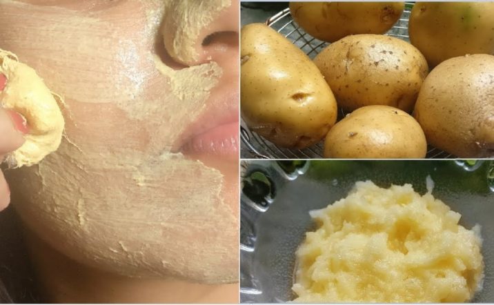 Sızanaqları yox edir, dərini parıldadır