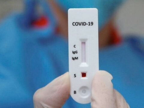Rusiyalı mikrobioloq alim: “Koronavirus ştamları təxminən hər səkkiz aydan bir dəyişir”