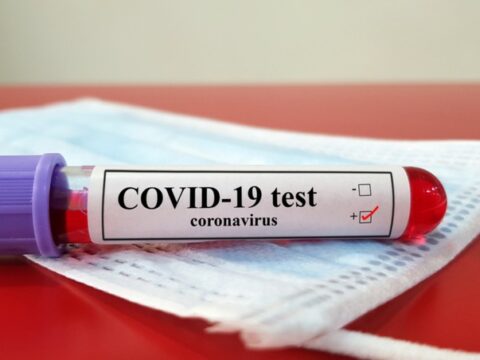 ÜST: “Koronavirus pandemiyasının sonu yaxınlaşır”