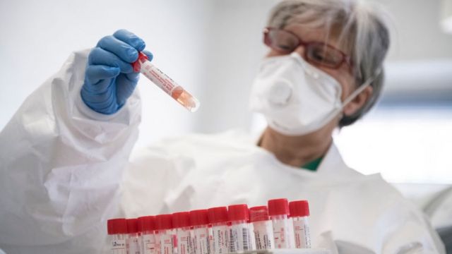 Dünyanın COVID statistikası: 618 milyon nəfər…