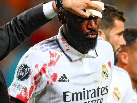 Həlledici qol “Real”ın futbolçusuna alnında 20 tikişə başa gəldi