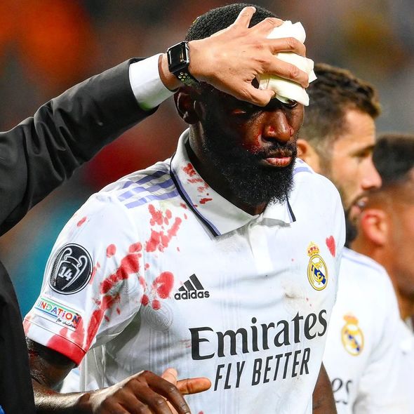 Həlledici qol “Real”ın futbolçusuna alnında 20 tikişə başa gəldi