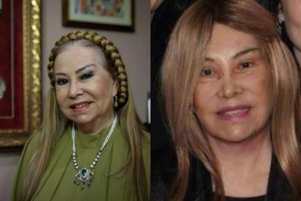 81 yaşlı türkiyəli sənətçi estetik əməliyyat etdirib tanınmaz oldu