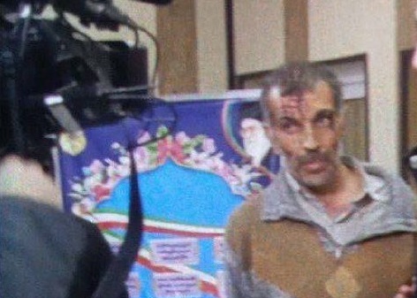 Səfirliyimizə hücum edən terrorçunun FOTOSU