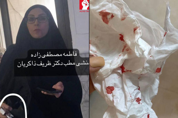 İranda rejim tərəfdarı hicabsız qadına hücum edərək yaralayıb