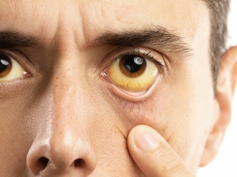 Azərbaycanda “Hepatit” təşvişi: Virus su ilə yayılır?