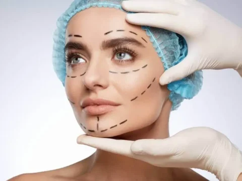 Plastik cərrahlara rüşvətlə sertifikasiya verən vəzifəli şəxslər – Adlar AÇIQLANDI