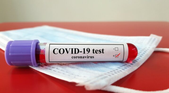 ÜST: “Koronavirus pandemiyasının sonu yaxınlaşır” ÜST: “Koronavirus pandemiyasının sonu yaxınlaşır”